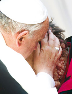 baiser au lépreux du pape François 1er