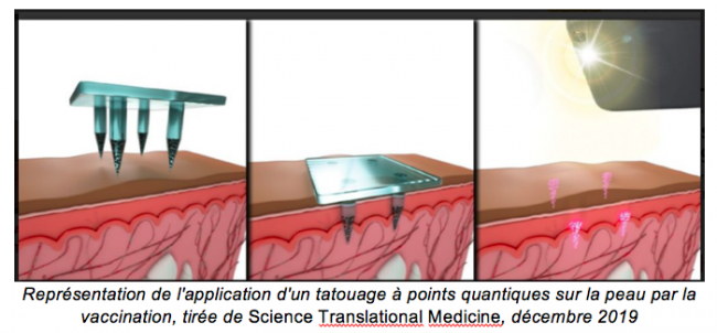 "Human implantable quantum dot microneedle vaccination delivery system"