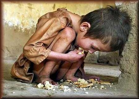 enfant souffrant de malnutrition